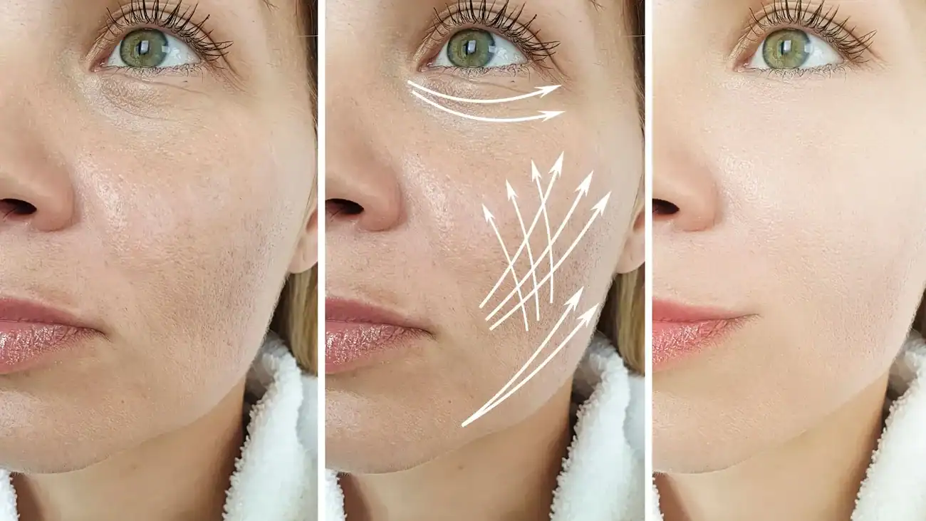Can One Treatment Really Tackle More Than One Skin Concern Wiltshire?