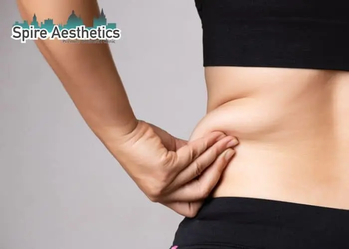 Image of woman pinching fat on their hips Wiltshire. Fat Freezing treatment