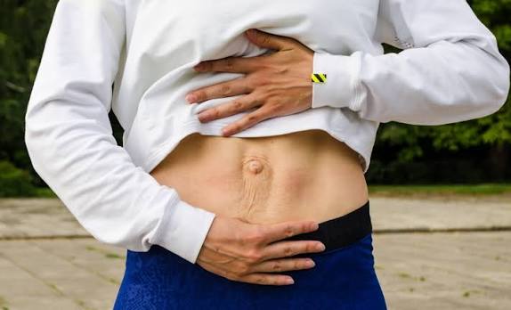 When Could Diastasis Recti Be the Missing Piece of the Puzzle Wiltshire?